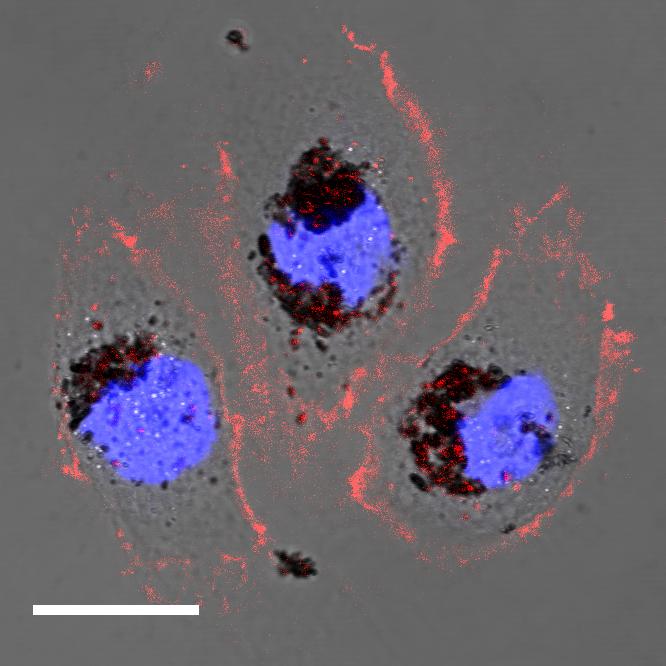Human cells treated with selenomelanin nanoparticles. Image Credit:
Northwestern University