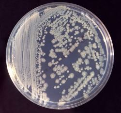 Antibiotic Resistant Bacteria has been Found on the Space Station's ...