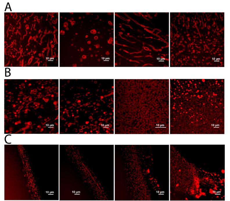 This figure from the research shows the vesicle-like structures that formed after concentrated sulfuric acid was added to solid lipids. Each panel is a different region of the same sample taken on the same day. Subsequent images showed that the structures remained intact even after seven days. Image Credit: Duzdevich et al. 2024. 