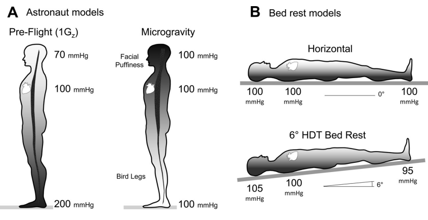 This figure shows how HDT bed rest is used as an analogue for astronauts during long-duration microgravity spaceflight. Image Credit: Hargens AR et al. 2016.